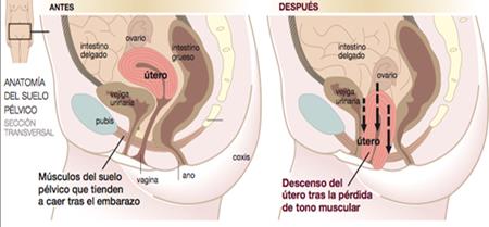 El suelo pélvico; para mujeres y hombres | Fita - Centro de fisioterapia, ejercicio terapéutico, readaptación y nutrición - Fisioterapeuta Barcelona
